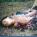 Cluster Bombs And Other Top Selling Products - Cluster Bomb Victim