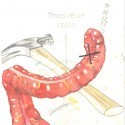My Last Party - The Hammer And Colon